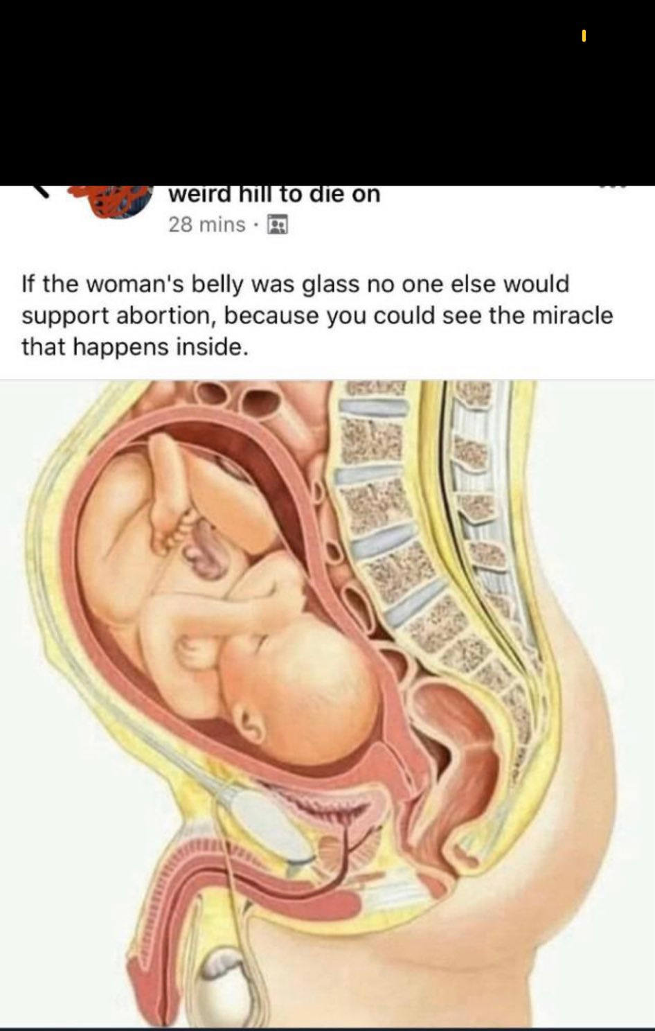 Trans Blank Template Imgflip