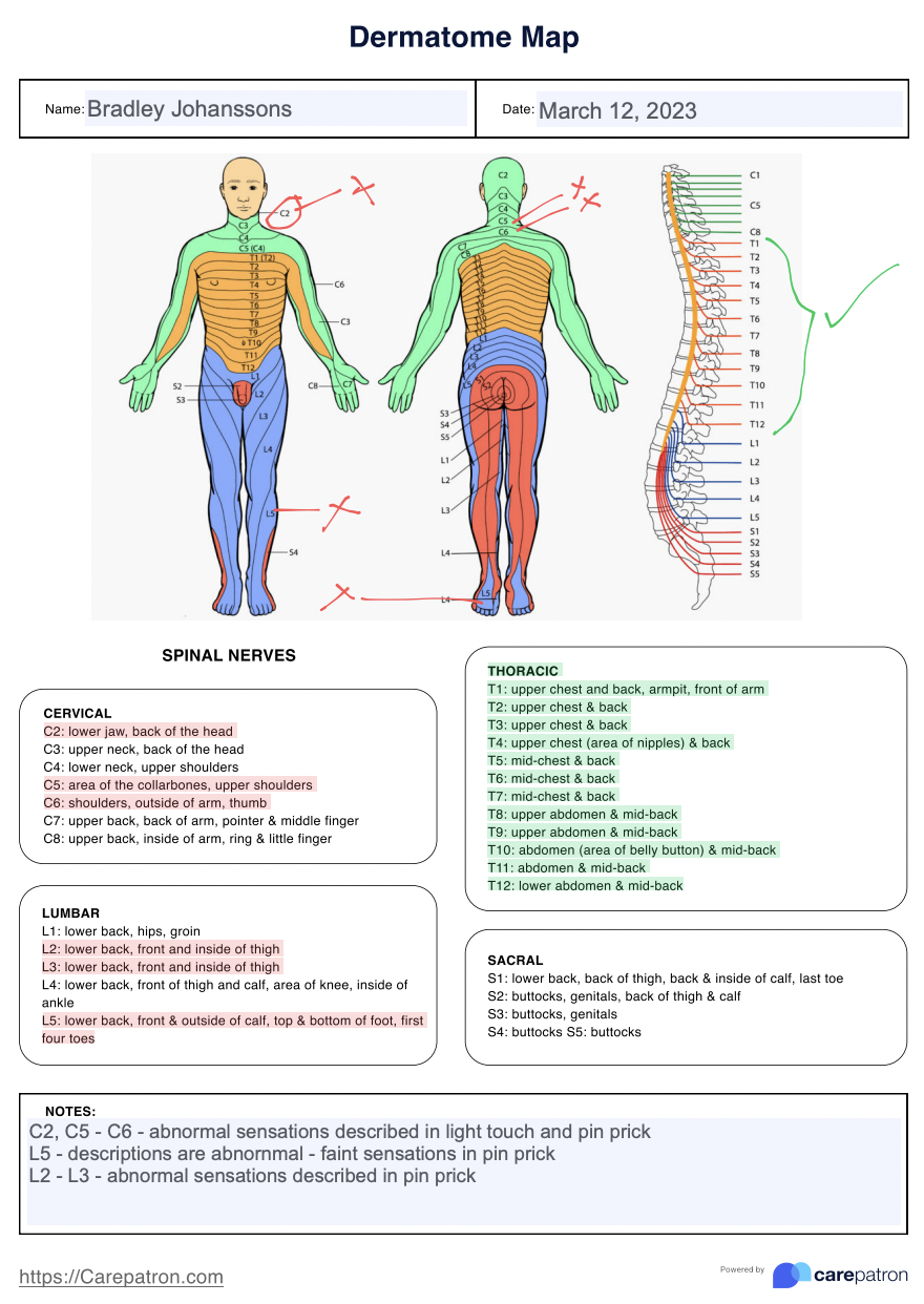 Dermatomes Anatomical Chart Of Face Understanding Dermatomes Chart HPC International Dermatome Chart Printable Pdf